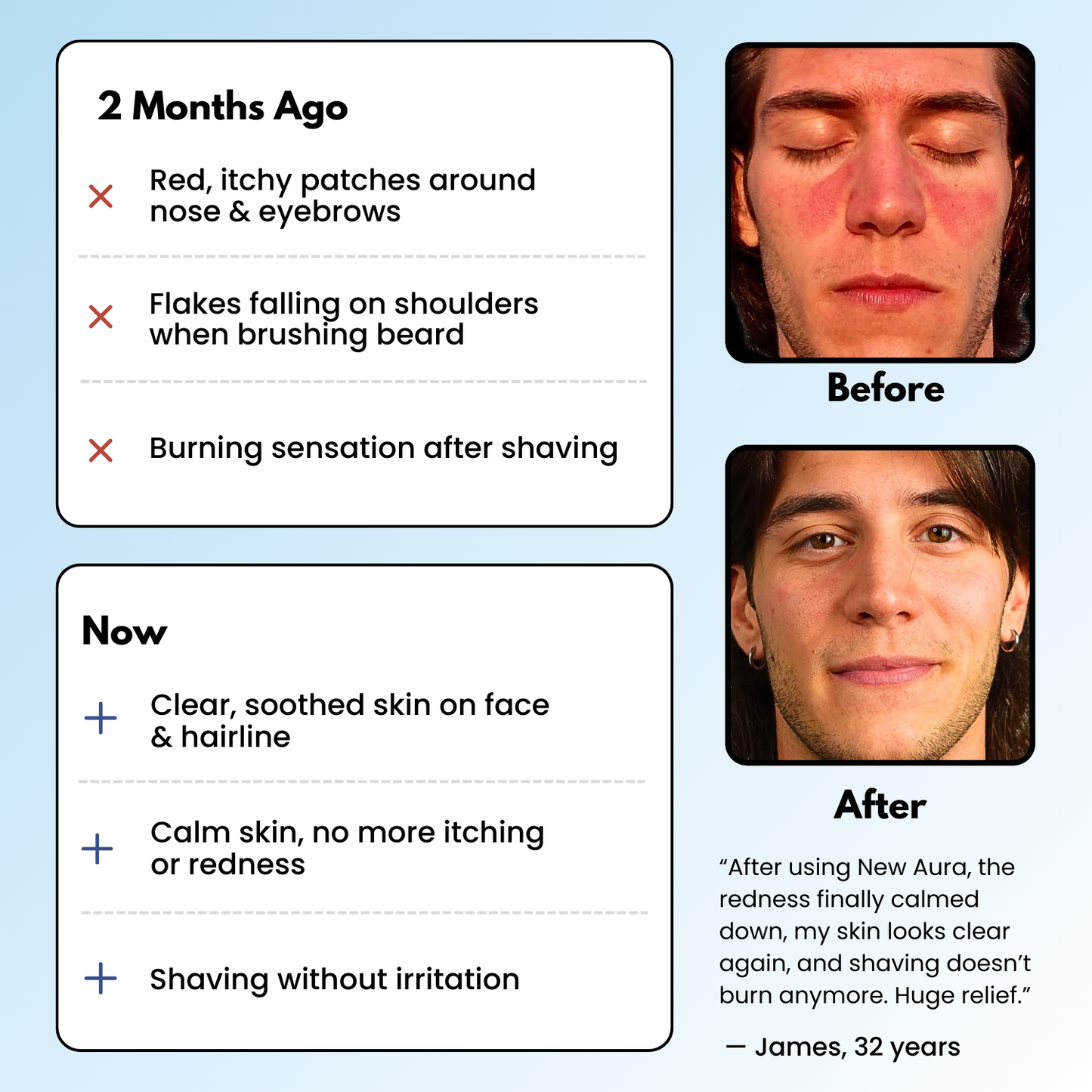 NewAura™ Skin Recovery Bundle