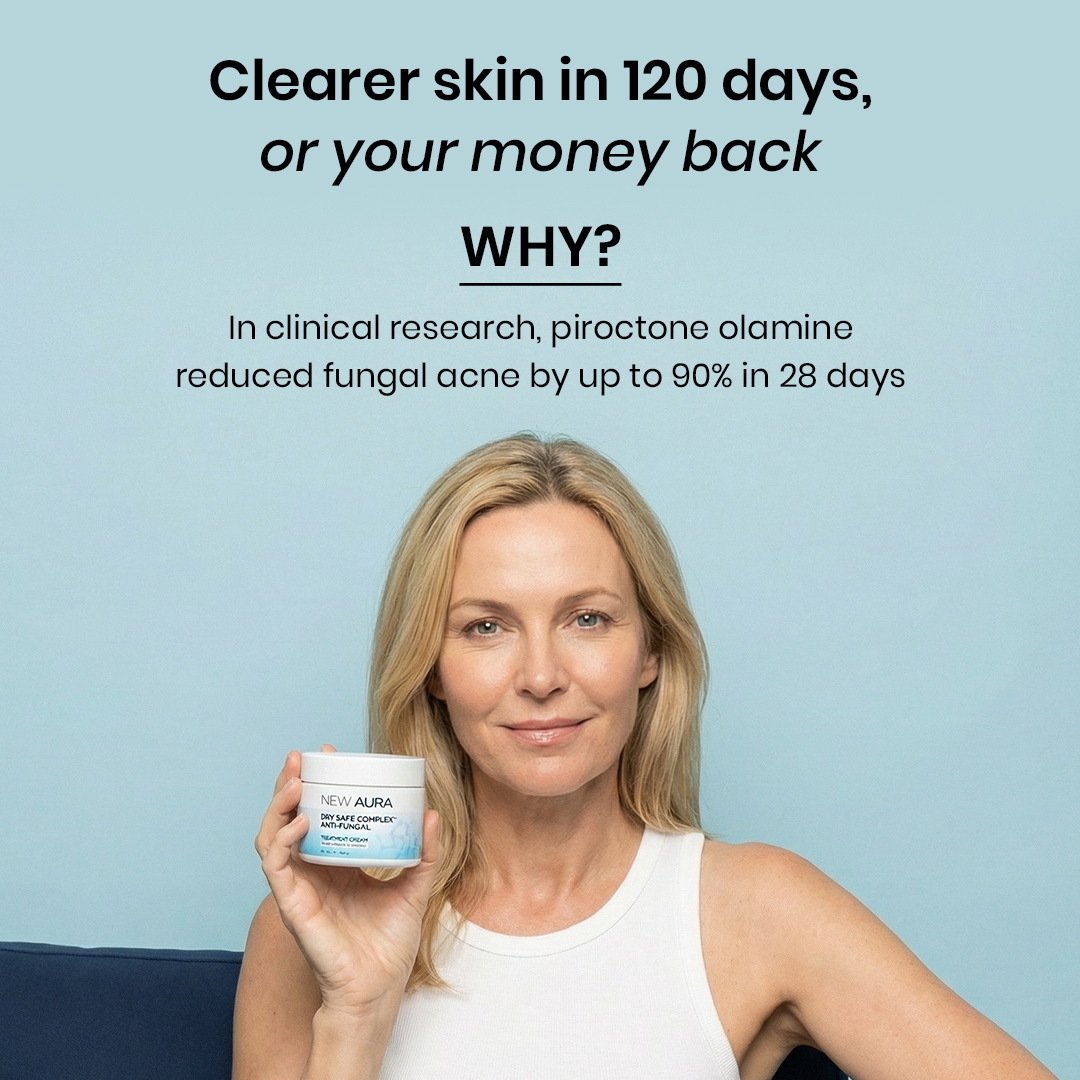 New Aura™ Anti-Fungal Acne Cream
