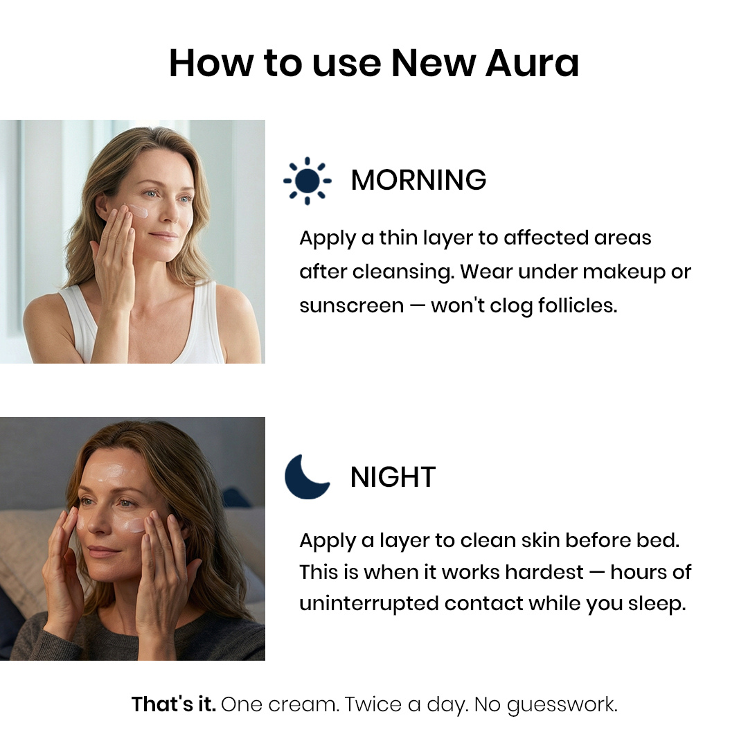 New Aura™ Anti-Fungal Acne Cream
