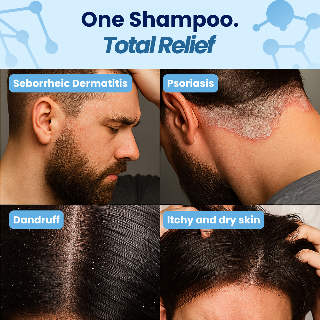 Seborrheic Dermatitis & Psoriasis Shampoo