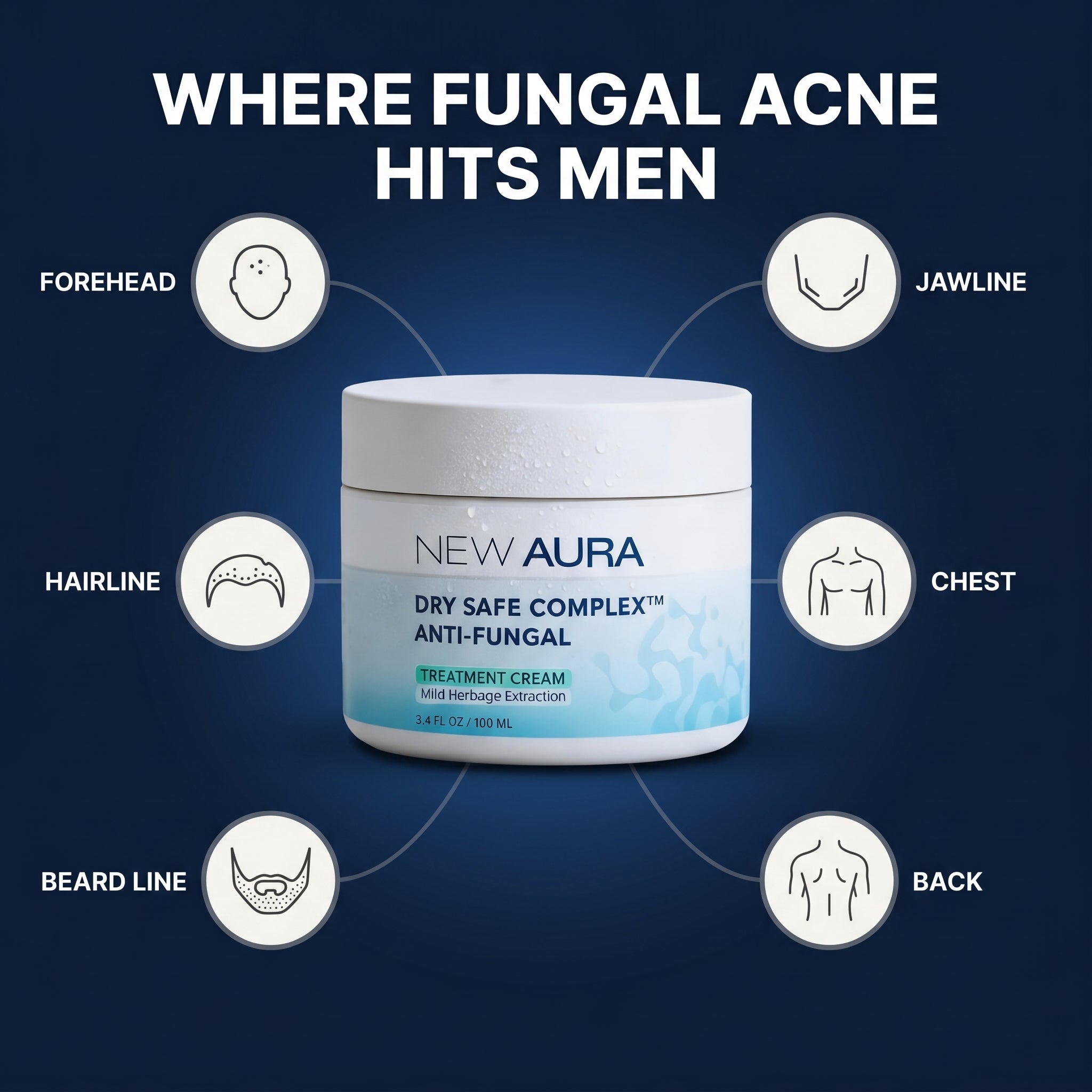 New Aura™ Men's Anti-Fungal Acne Cream