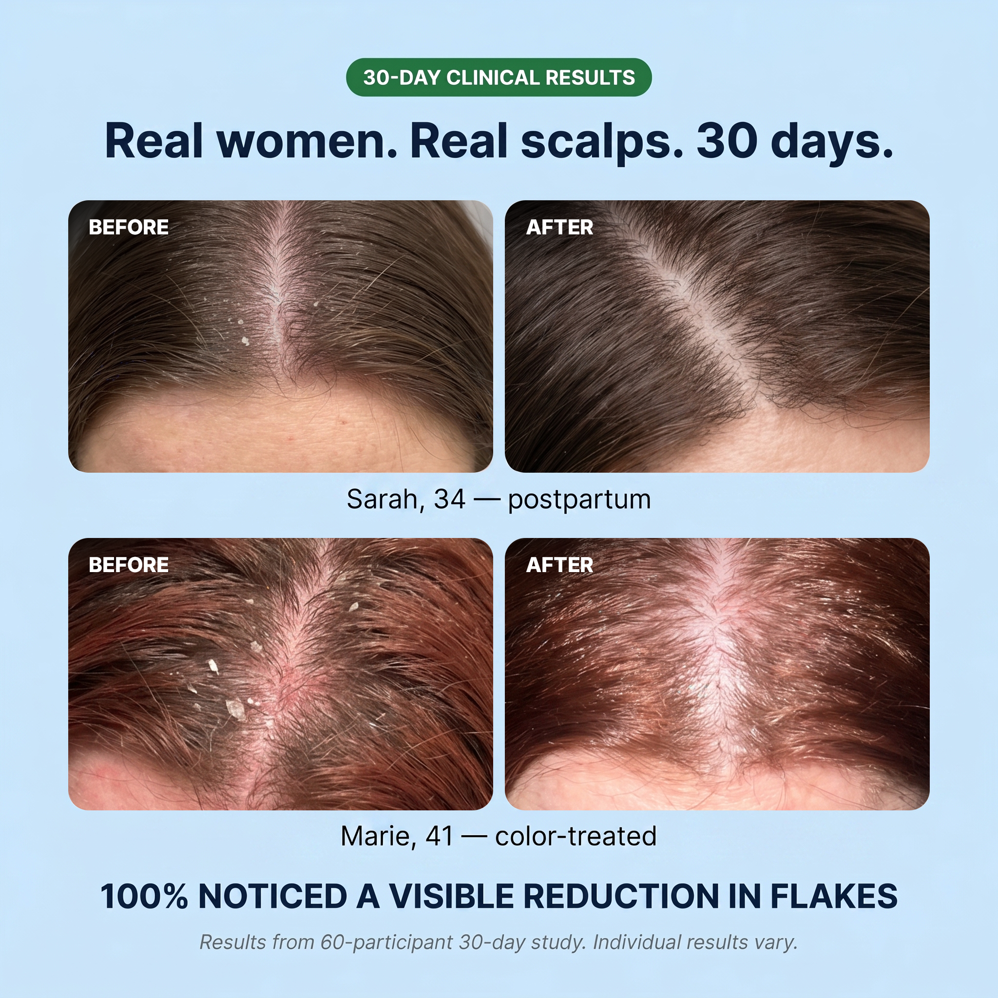 New Aura™ Anti-Fungal Shampoo